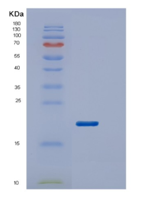 Recombinant Human VHL protein (β-domain : 1-154aa),Recombinant Human VHL protein (β-domain : 1-154aa)