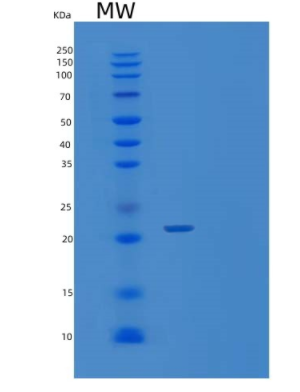 Recombinant Human Visinin-like protein-1,Recombinant Human Visinin-like protein-1