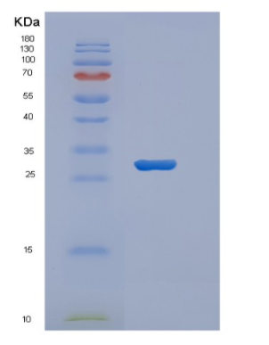 Recombinant Human VTCN1 Protein,Recombinant Human VTCN1 Protein