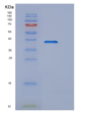 Recombinant Human WDR5 Protein,Recombinant Human WDR5 Protein