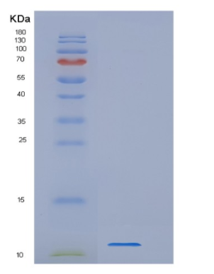 Recombinant Human WFDC12 Protein,Recombinant Human WFDC12 Protein