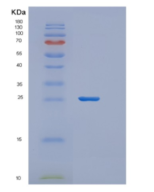 Recombinant Human ZFAND5 Protein,Recombinant Human ZFAND5 Protein