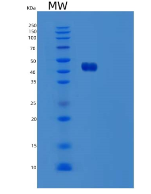 Recombinant Human Ubiquitin-Conjugating Enzyme E2 G2/UBE2G2/UBC7 Protein(N-GST),Recombinant Human Ubiquitin-Conjugating Enzyme E2 G2/UBE2G2/UBC7 Protein(N-GST)