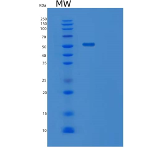 Recombinant Human VPS4B Protein,Recombinant Human VPS4B Protein