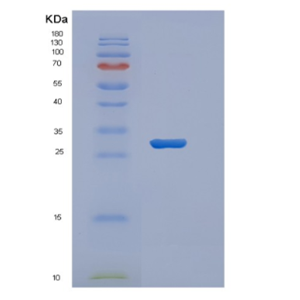 Recombinant Human VTCN1 Protein