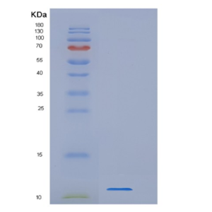 Recombinant Human WFDC12 Protein,Recombinant Human WFDC12 Protein