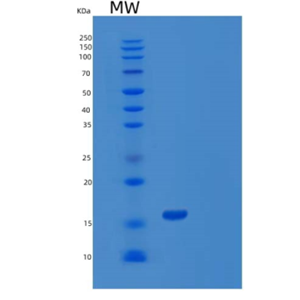 Recombinant Human WWC1 Protein,Recombinant Human WWC1 Protein