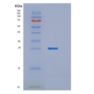 Recombinant Human ZFAND5 Protein,Recombinant Human ZFAND5 Protein