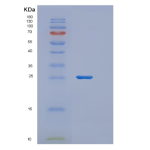 Recombinant Human ZFAND5 Protein