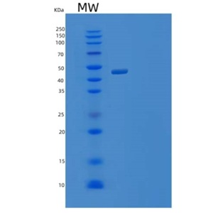 Recombinant Mouse Ephrin-A1/EFNA1 Protein(C-Fc-6His)