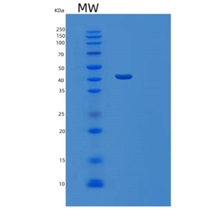 Recombinant Mouse Ephrin-A4/EFNA4 Protein(C-Fc)