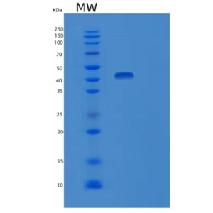Recombinant Human Ubiquitin-Conjugating Enzyme E2 D4 Protein