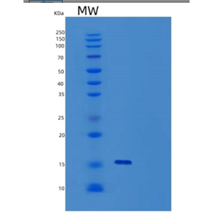 Recombinant Interferon Gamma (IFNg),Recombinant Interferon Gamma (IFNg)