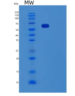 Recombinant Human Fibronectin Fragment/RetroNectin/NovoNectin Protein,Recombinant Human Fibronectin Fragment/RetroNectin/NovoNectin Protein