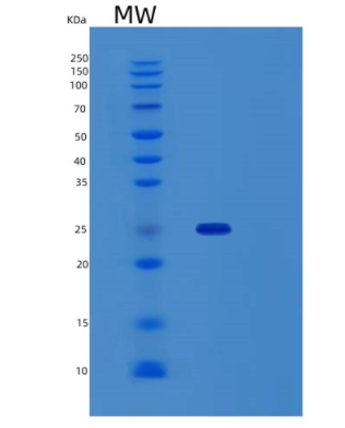 Recombinant Human Sentrin-Specific Protease 2/SENP2 Protein(N-6His, SUMO tag),Recombinant Human Sentrin-Specific Protease 2/SENP2 Protein(N-6His, SUMO tag)