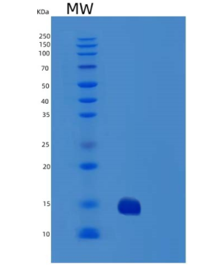 Recombinant Human TRAIL R2/TNFRSF10B/DR5/CD262 Protein(C-6His),Recombinant Human TRAIL R2/TNFRSF10B/DR5/CD262 Protein(C-6His)