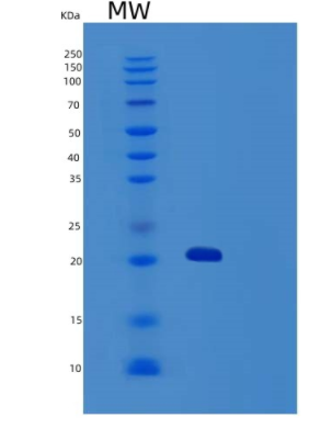 Recombinant Human TRAIL R3/TNFRSF10C/CD263 Protein(C-6His),Recombinant Human TRAIL R3/TNFRSF10C/CD263 Protein(C-6His)