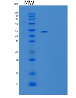 Recombinant Human Glial Cell line-derived Neurotrophic Factor Receptor alpha 2 Protein,Recombinant Human Glial Cell line-derived Neurotrophic Factor Receptor alpha 2 Protein