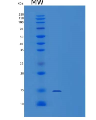 Recombinant Human CDK2AP2 Protein(C-6His),Recombinant Human CDK2AP2 Protein(C-6His)