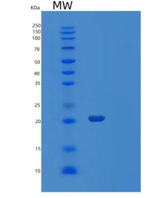 Recombinant Human Heat Shock Protein β-2//HSPB2/MKBP Protein(C-6His),Recombinant Human Heat Shock Protein β-2//HSPB2/MKBP Protein(C-6His)