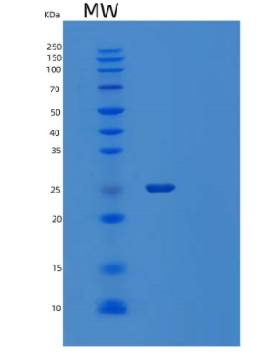 Recombinant Mouse Programmed Cell Death 1 Ligand 1 Protein,Recombinant Mouse Programmed Cell Death 1 Ligand 1 Protein