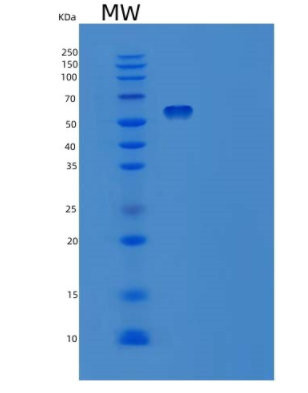 Recombinant Human Ephrin A Receptor 2 Protein,Recombinant Human Ephrin A Receptor 2 Protein