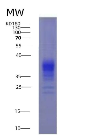 Eukaryotic Interferon Gamma (IFNg),Eukaryotic Interferon Gamma (IFNg)