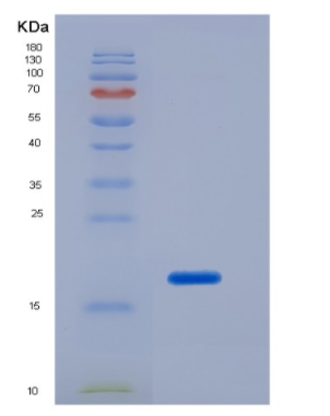 Eukaryotic Interleukin 2 (IL2),Eukaryotic Interleukin 2 (IL2)