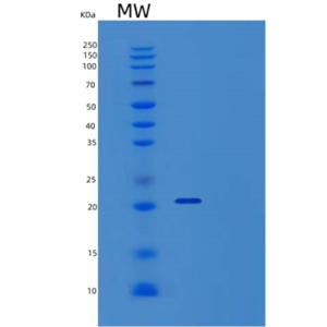 Recombinant Human RANK/TNFRSF11A/CD265 Protein(C-6His)