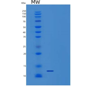 Recombinant Human γ-Synuclein/SNCG Protein