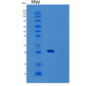 Recombinant Human TRAIL R3/TNFRSF10C/CD263 Protein(C-6His)