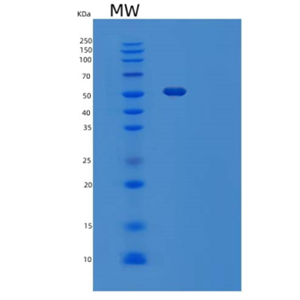 Recombinant Mouse Vitronectin / VTN Protein (His tag)