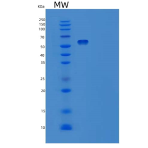 Recombinant Human Ephrin A Receptor 2 Protein,Recombinant Human Ephrin A Receptor 2 Protein