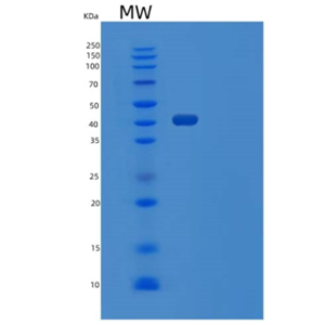 Recombinant Human 4-1BB/TNFRSF9/CD137 Protein(C-Fc-6His)
