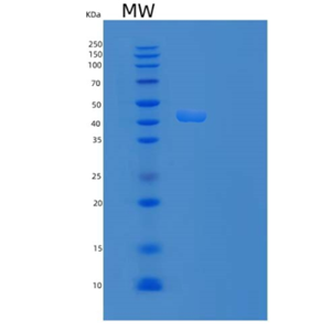 Recombinant Human Platelet Receptor Gi24/VISTA/B7-H5/PD-1H Protein(C-Fc)