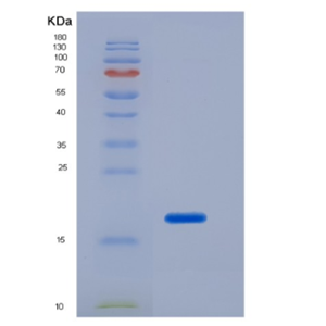 Eukaryotic Interleukin 2 (IL2),Eukaryotic Interleukin 2 (IL2)