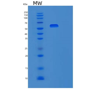 Recombinant Human Platelet-Derived Growth Factor Receptor β/PDGFR-β Protein(C-6His)