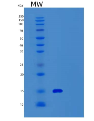 Recombinant Mouse α-Synuclein/SNCA Protein,Recombinant Mouse α-Synuclein/SNCA Protein