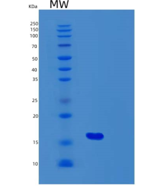 Recombinant Human Fibroblast Growth Factor 2/FGF-2/FGFb(Gly132-Ser288) Protein,Recombinant Human Fibroblast Growth Factor 2/FGF-2/FGFb(Gly132-Ser288) Protein