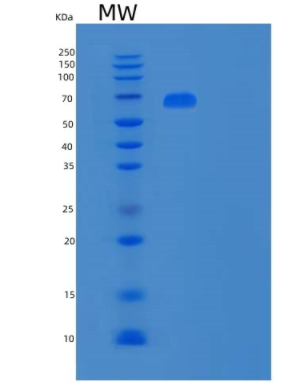 Recombinant Human Polymeric Immunoglobulin Receptor Protein,Recombinant Human Polymeric Immunoglobulin Receptor Protein