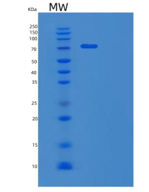 Recombinant Human GDNF Family Receptor α-1/GFRA1 Protein(C-Fc),Recombinant Human GDNF Family Receptor α-1/GFRA1 Protein(C-Fc)