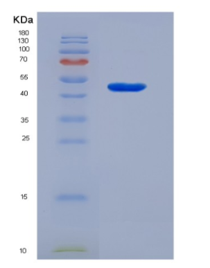 Eukaryotic Cluster Of Differentiation 14 (CD14),Eukaryotic Cluster Of Differentiation 14 (CD14)