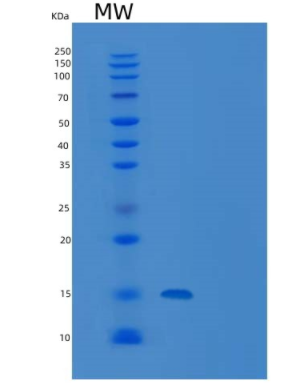 Recombinant Human CD160/BY55 Protein(C-6His),Recombinant Human CD160/BY55 Protein(C-6His)