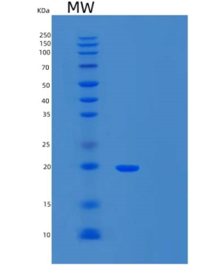 Recombinant Mouse T cell Immunoglobulin and Mucin Domain-3 Protein,Recombinant Mouse T cell Immunoglobulin and Mucin Domain-3 Protein