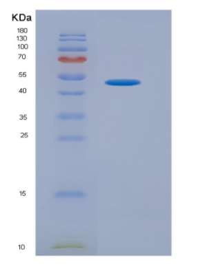 Eukaryotic High Mobility Group Protein 1 (HMGB1),Eukaryotic High Mobility Group Protein 1 (HMGB1)