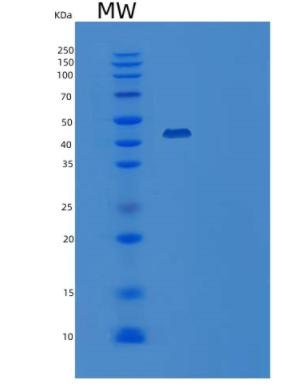 Recombinant Human CD147 / EMMPRIN / Basigin Protein (Fc tag),Recombinant Human CD147 / EMMPRIN / Basigin Protein (Fc tag)