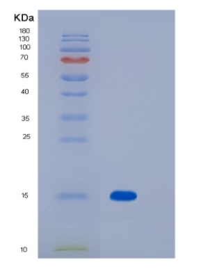 Recombinant Human Myelin Oligodendrocyte Glycoprotein/MOG Protein(C-6His),Recombinant Human Myelin Oligodendrocyte Glycoprotein/MOG Protein(C-6His)