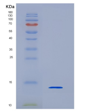 Eukaryotic Insulin Like Growth Factor 1 (IGF1),Eukaryotic Insulin Like Growth Factor 1 (IGF1)