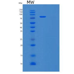 Recombinant Human Macrophage Colony-stim. Factor 1 Receptor/M-CSF R/CSF1R/CD115 Protein(C-Fc),Recombinant Human Macrophage Colony-stim. Factor 1 Receptor/M-CSF R/CSF1R/CD115 Protein(C-Fc)