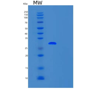 Recombinant Human Carbonic Anhydrase 13/CA13 Protein(C-6His),Recombinant Human Carbonic Anhydrase 13/CA13 Protein(C-6His)